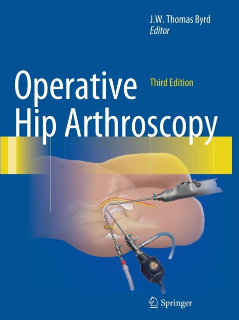 Book cover of: Operative Hip Arthroscopy. By: J.W. Thomas Byrd