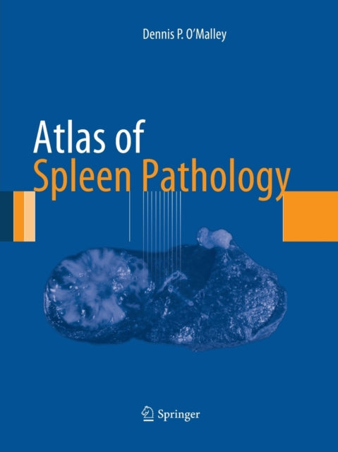 Book cover of: Atlas of Spleen Pathology. By: Dennis P. O'Malley