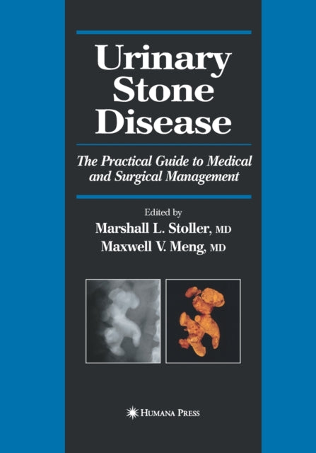 Book cover of: Urinary Stone Disease. By: Marshall L. Stoller