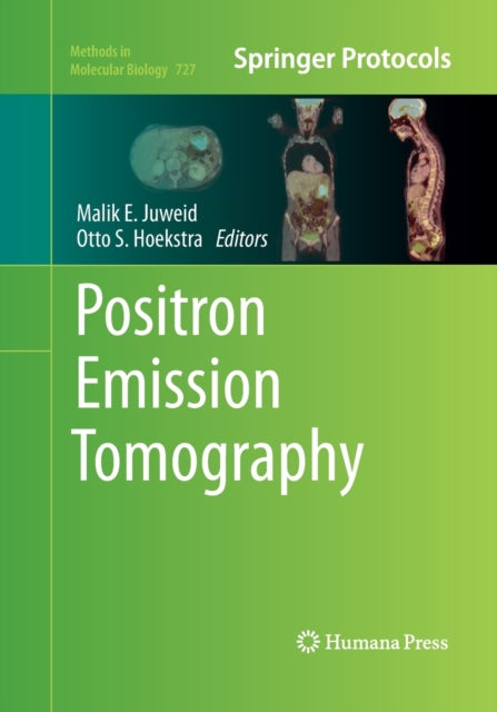 Book cover of: Positron Emission Tomography. By: Malik E. Juweid