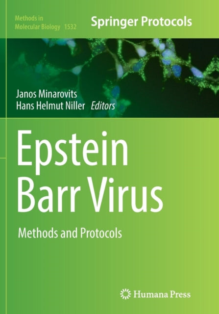 Book cover of: Epstein Barr Virus. By: Janos Minarovits