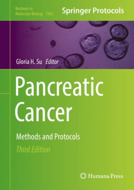 Book cover of: Pancreatic Cancer. By: Gloria H. Su