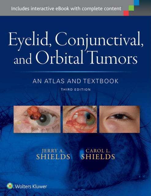 Book cover of: Eyelid, Conjunctival, and Orbital Tumors: An Atlas and Textbook. By: Jerry A. Shields