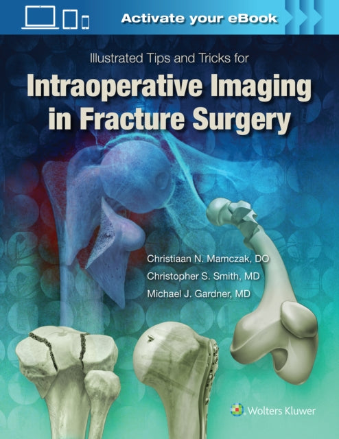 Book cover of: Illustrated Tips and Tricks for Intraoperative Imaging in Fracture Surgery. By: Michael J. Gardner