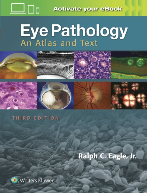 Book cover of: Eye Pathology. By: Ralph C. Eagle Jr. MD