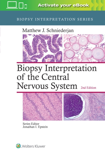 Book cover of: Biopsy Interpretation of the Central Nervous System. By: Matthew J. Schniederjan MD