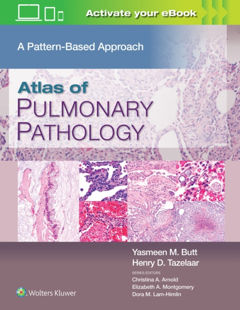 Book cover of: Atlas of Pulmonary Pathology. By: Yasmeen Mahmood Butt MD
