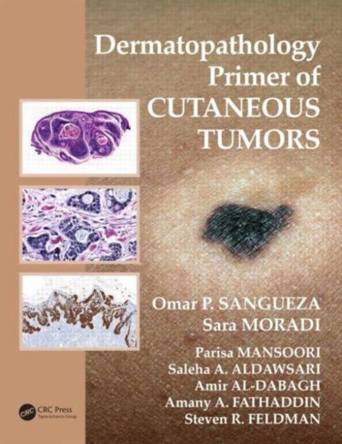 Book cover of: Dermatopathology Primer of Cutaneous Tumors. By: Omar P. Sangueza