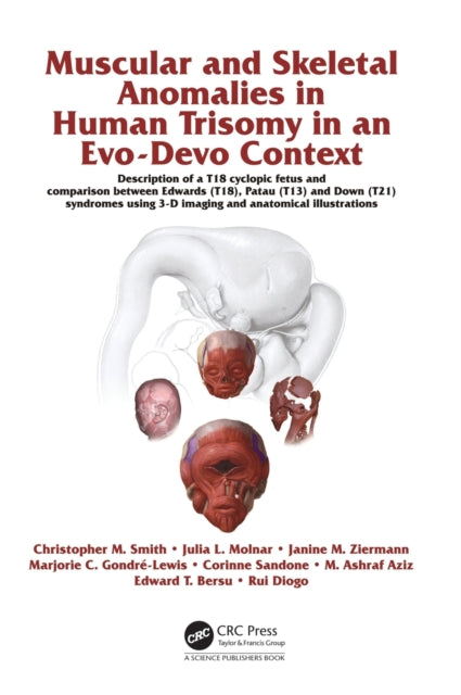Book cover of: Muscular and Skeletal Anomalies in Human Trisomy in an Evo-Devo Context. By: Rui Diogo