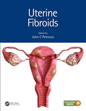 Uterine Fibroids