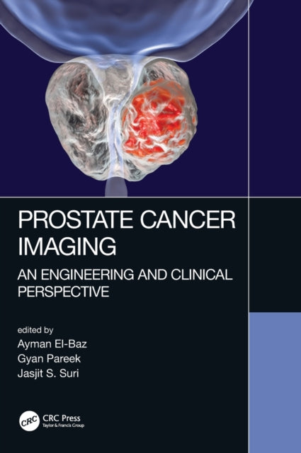 Book cover of: Prostate Cancer Imaging. By: Ayman El-Baz