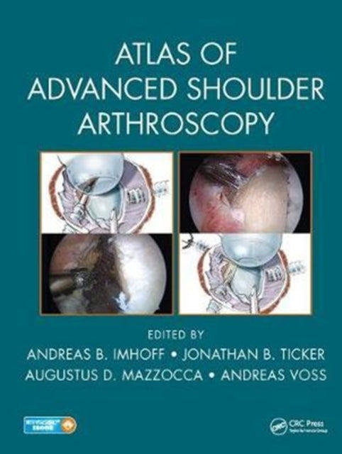 Book cover of: Atlas of Advanced Shoulder Arthroscopy. By: Andreas B. Imhoff
