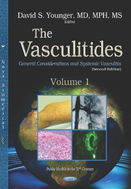 Book cover of: Vasculitides. By: David Steven Younger