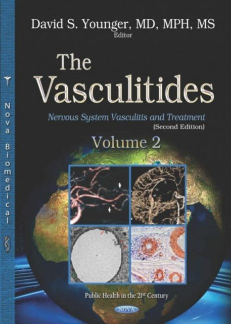 Book cover of: Vasculitides. By: David Steven Younger