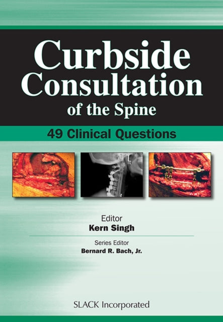 Book cover of: Curbside Consultation of the Spine