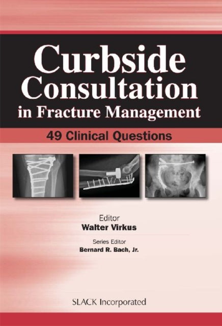 Book cover of: Curbside Consultation in Fracture Management