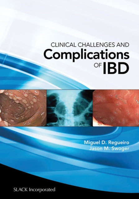 Book cover of: Clinical Challenges and Complications of IBD. By: Miguel Regueiro