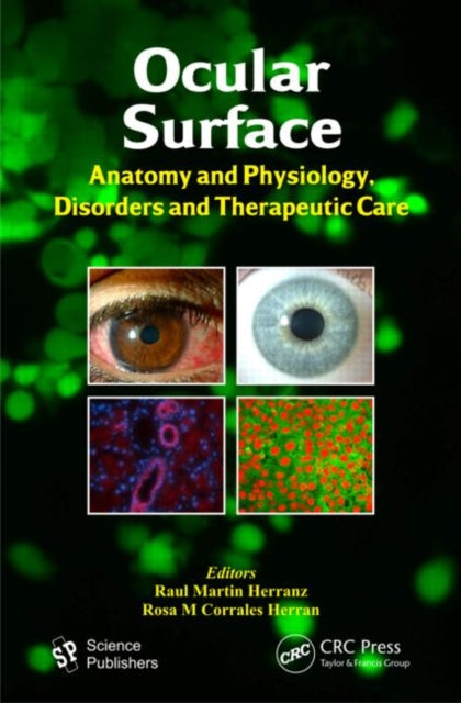 Book cover of: Ocular Surface. By: Raul Martin Herranz