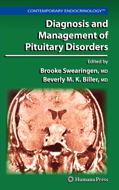 Book cover of: Diagnosis and Management of Pituitary Disorders
