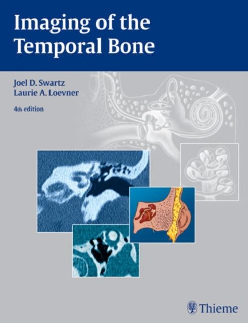 Book cover of: Imaging of the Temporal Bone. By: Joel D. Swartz