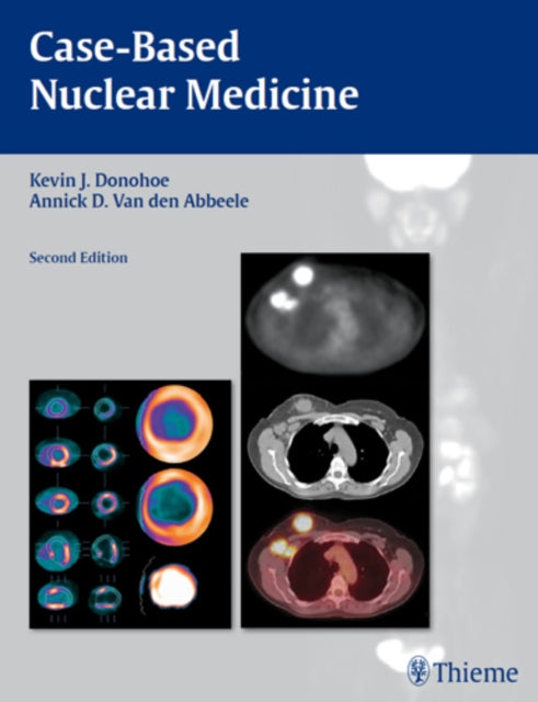 Book cover of: Case-Based Nuclear Medicine. By: Kevin J. Donohoe