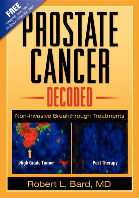 Book cover of: Prostate Cancer Decoded. By: Robert L. Bard