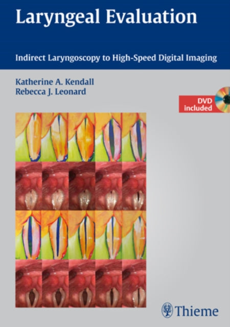Book cover of: Laryngeal Evaluation