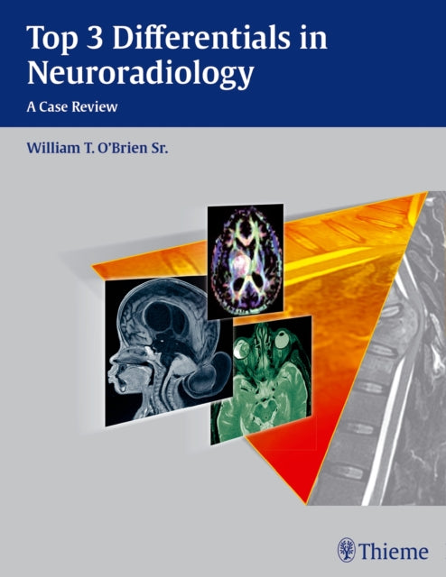 Book cover of: Top 3 Differentials in Neuroradiology. By: William T. O'Brien