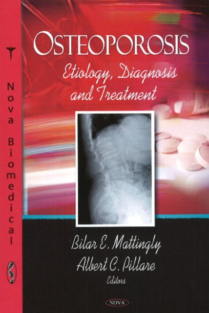Book cover of: Osteoporosis