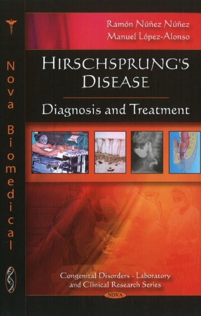 Book cover of: Hirschsprung's Disease