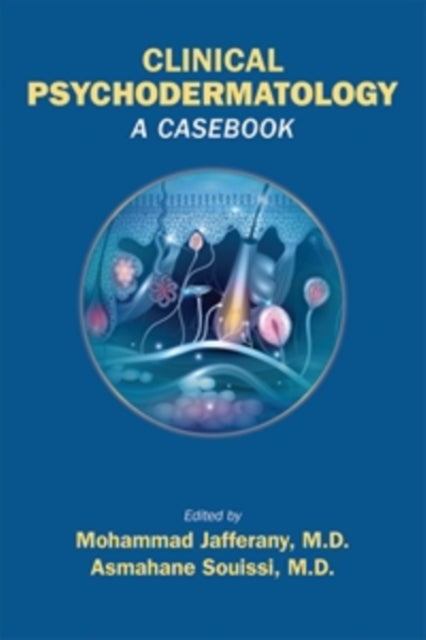 Book cover of: Clinical Psychodermatology. By: Mohammad Jafferany