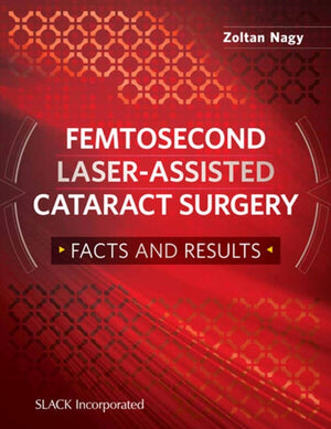 Femtosecond Laser-Assisted Cataract Surgery