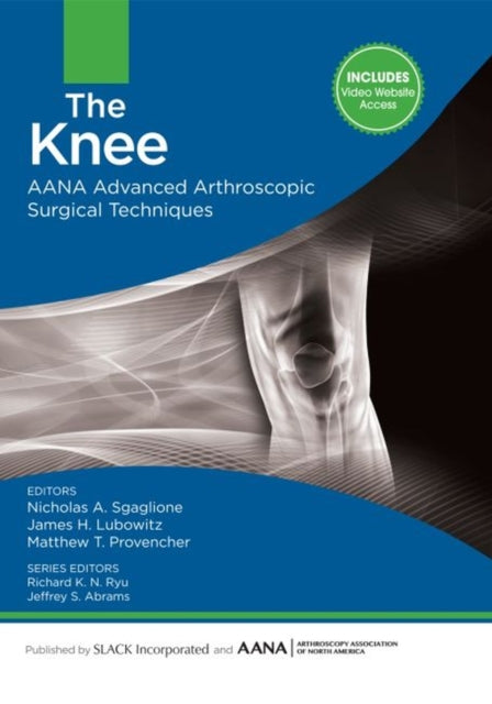 Book cover of: Knee. By: Nicholas A Sgaglione