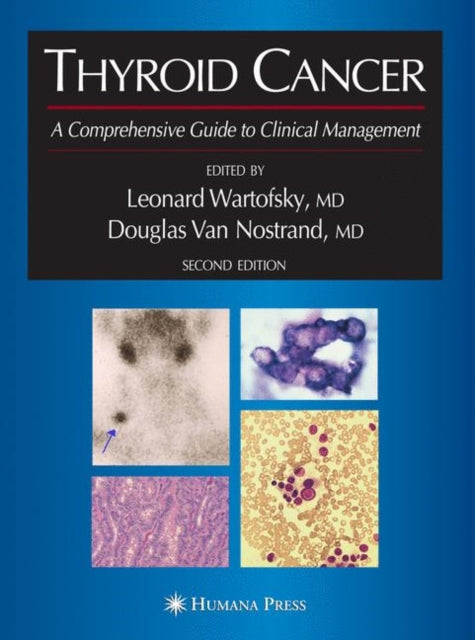 Book cover of: Thyroid Cancer. By: Leonard Wartofsky