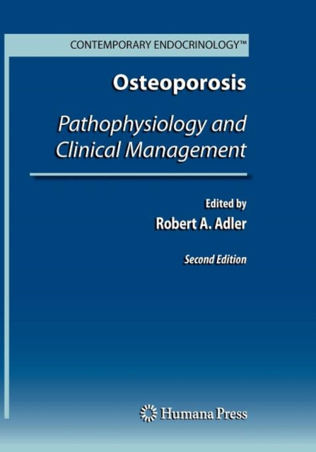 Book cover of: Osteoporosis