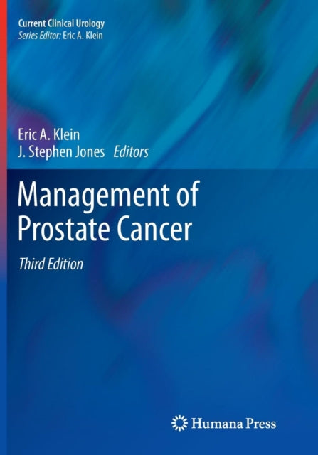 Book cover of: Management of Prostate Cancer. By: Eric A. Klein