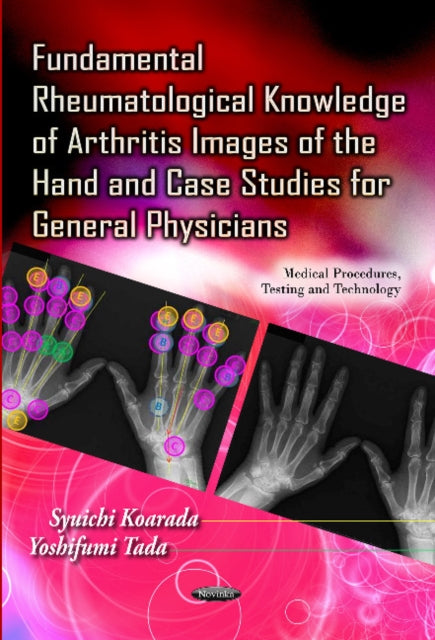 Book cover of: Fundamental Rheumatological Knowledge of Arthritis Images of the Hand & Case Studies for General Physicians