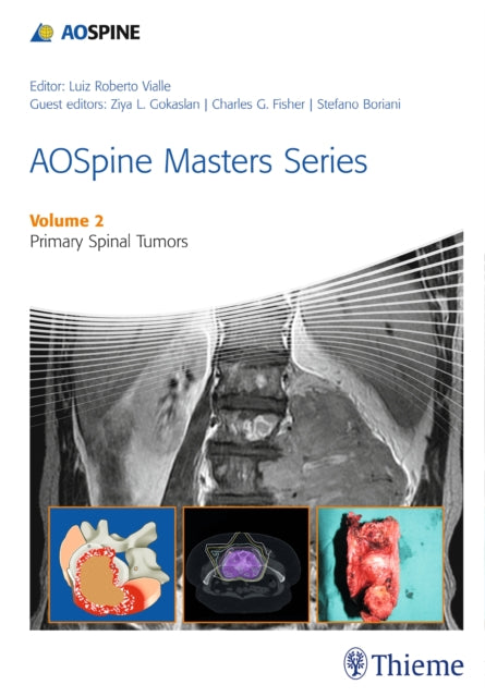 Book cover of: AOSpine Masters Series Volume 2: Primary Spinal Tumors. By: Luiz Vialle