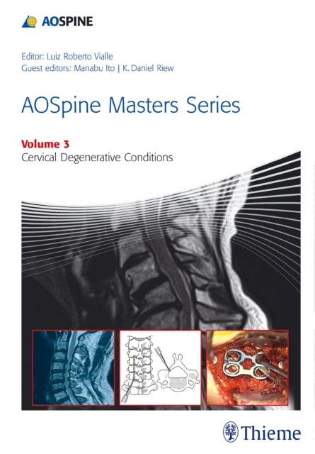 Book cover of: AOSpine Masters Series Volume 3: Cervical Degenerative Conditions. By: Luiz Roberto Vialle