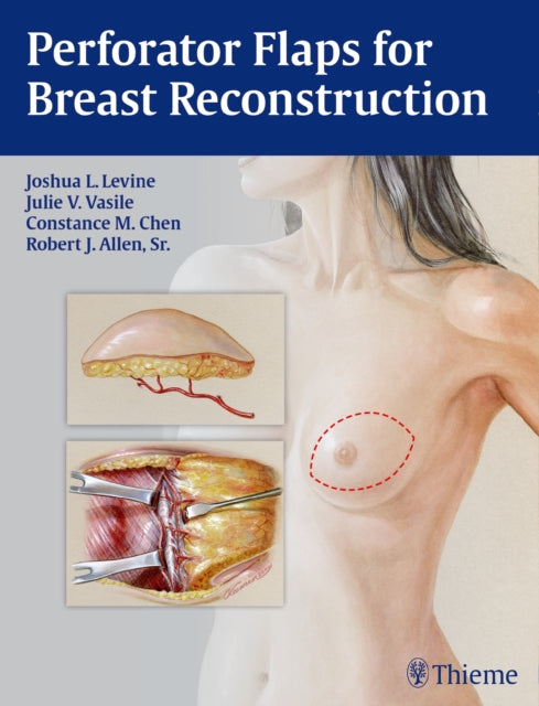 Book cover of: Perforator Flaps for Breast Reconstruction. By: Joshua L. Levine