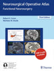 Book cover of: Neurosurgical Operative Atlas. By: Robert E. Gross