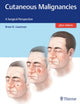Book cover of: Cutaneous Malignancies. By: Brian Gastman