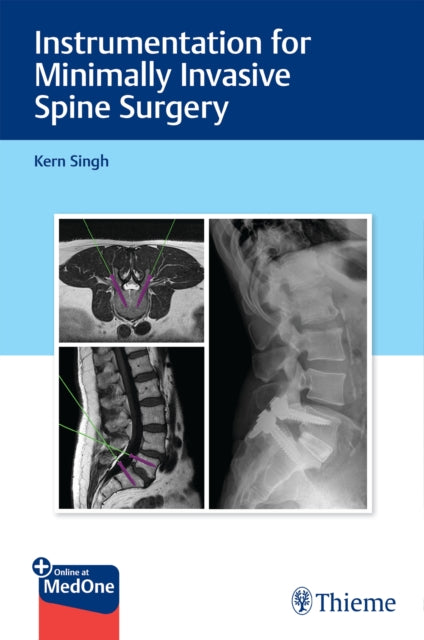 Book cover of: Instrumentation for Minimally Invasive Spine Surgery. By: Kern Singh