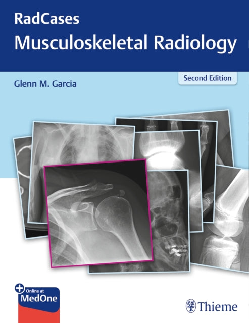 Book cover of: RadCases Q&a Musculoskeletal Radiology. By: Glenn M. Garcia