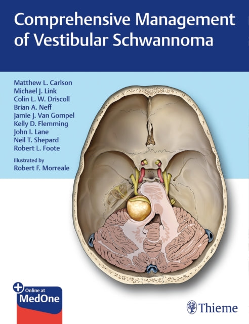 Book cover of: Comprehensive Management of Vestibular Schwannoma. By: Matthew L. Carlson