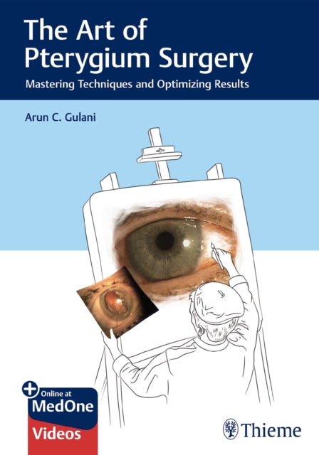Book cover of: Art of Pterygium Surgery. By: Arun C. Gulani