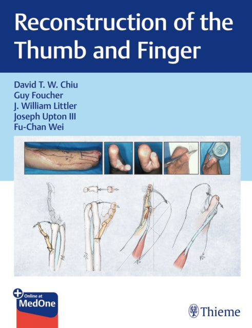 Book cover of: Reconstruction of the Thumb and Finger. By: David Chiu