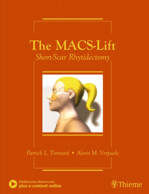 Book cover of: MACS-Lift. By: Patrick Tonnard