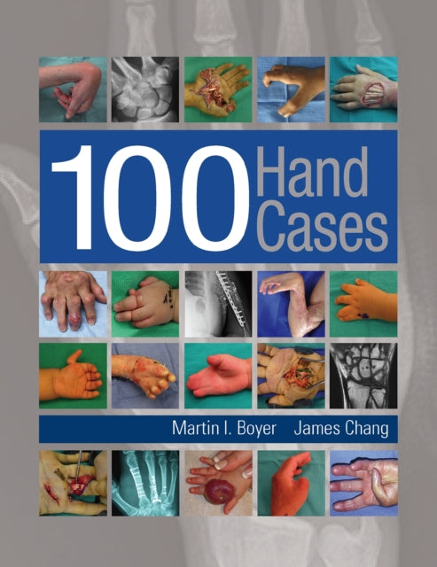 Book cover of: 100 Hand Cases. By: Martin Boyer