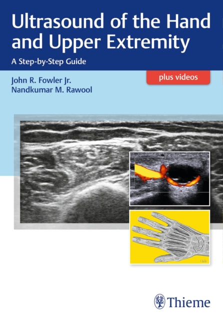 Book cover of: Ultrasound of the Hand and Upper Extremity. By: John R. Fowler